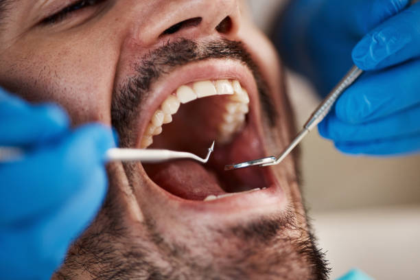 Best Emergency Treatment for Oral Infections in South River, NM