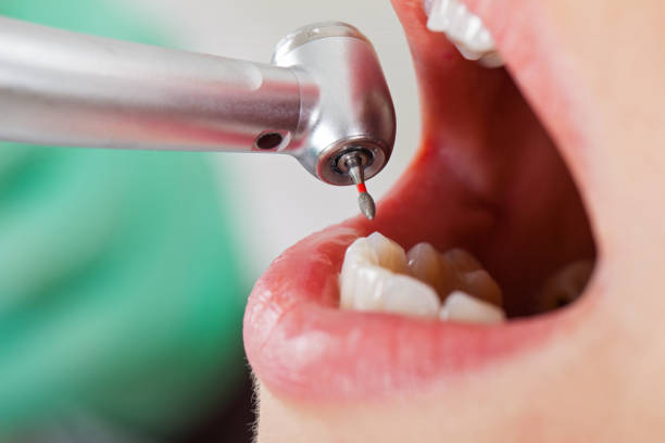 Best Urgent Dental Care for Toothaches in South River, NM